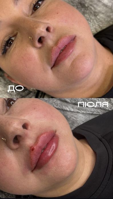 Лікар-Косметолог-Дерматолог Коммунарівський р-н,піски,4-й південний