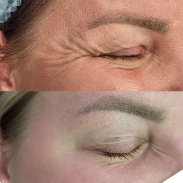 Лікар косметолог львів ботокс чистка обличя пілінг для обличя