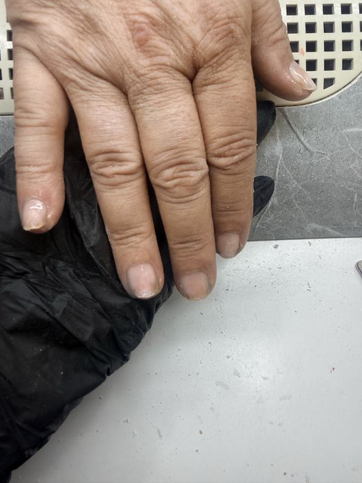 Unhas molde F1.