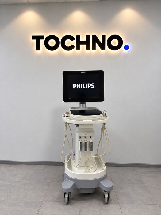 Philips Sparq  мобільний УЗД апарат Ультразвуковий апарат сканер аппарат УЗИ