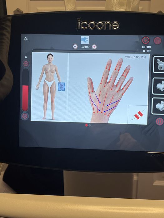 Icoone 2. Laser  nowy model
