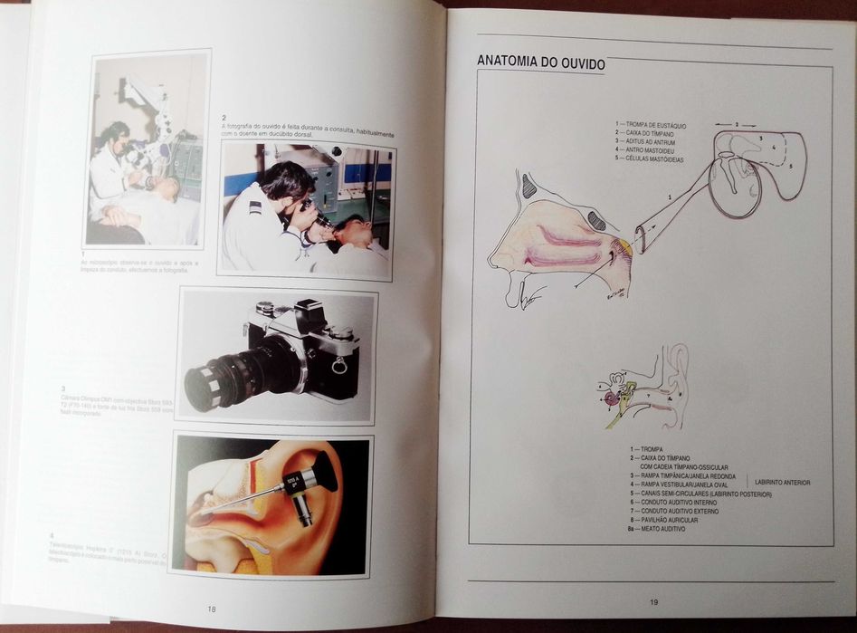 Atlas de Patologia do Ouvido