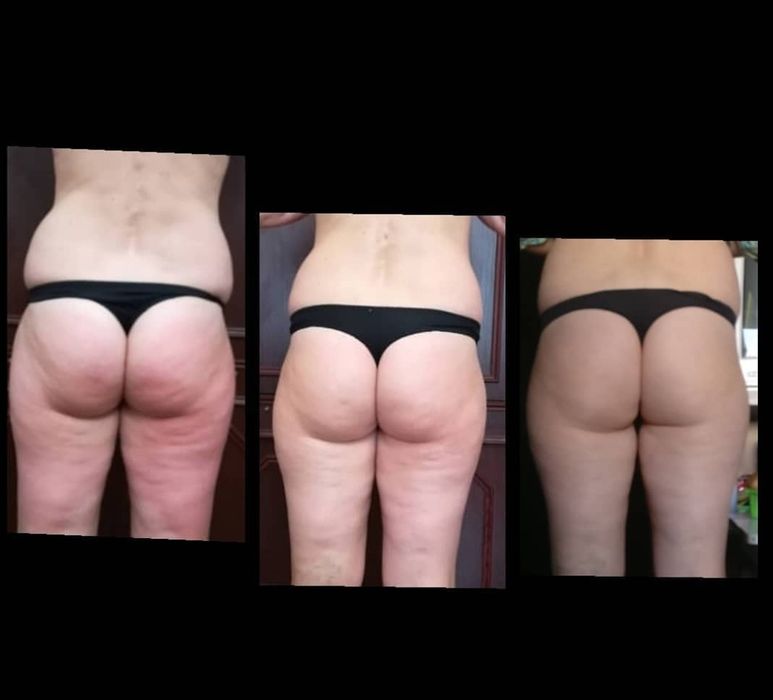 Антицелюлітний масаж (650 грн).Обгортання STYX. Віскі-сповивання.