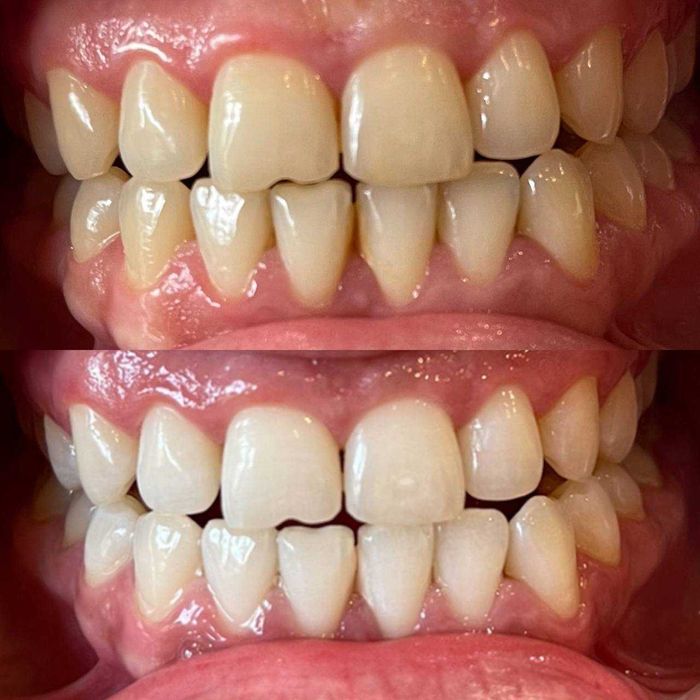 Косметичний бізнес / Франшиза відбілювання зубів Smile LAB