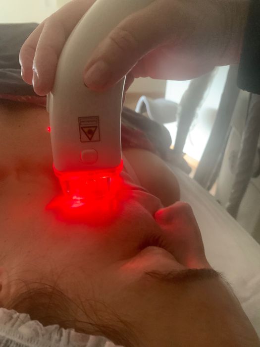 Velasmooth VelaShape Aparelho profissional de estética