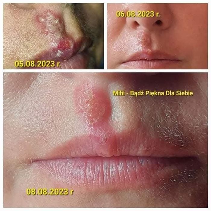 Krem Wielofunkcyjny NO PROBLEM 75ml