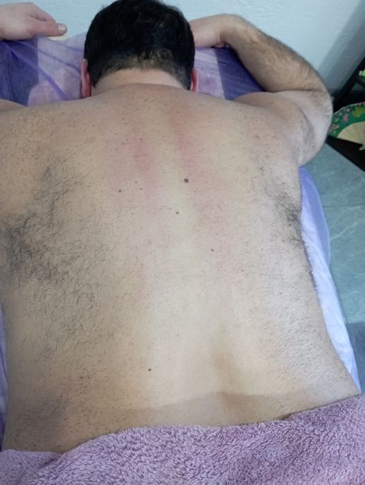 Оздоровительный, общий, антицеллюлитны,Вакуумный,Лимфодренажный массаж