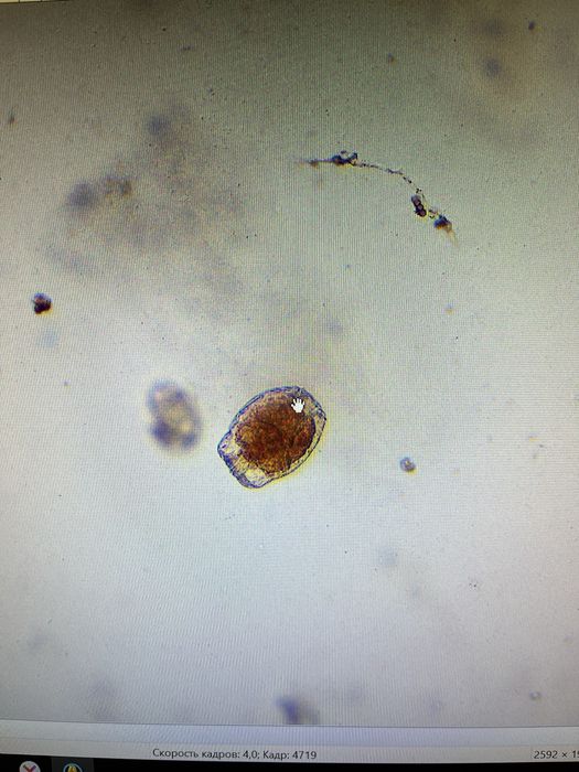 AmScope MU500 microscope camera