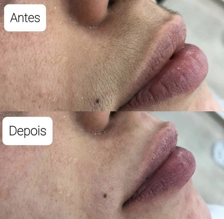 Design de Sobrancelhas + Buço | Promoção em Almada