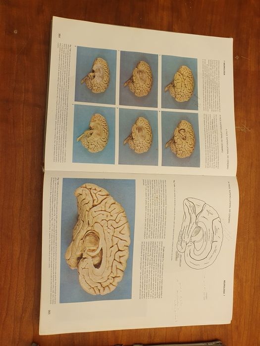 1a e 2a ediçao.  GRAY ANATOMIA