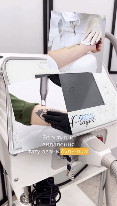 Neo-Light TL-500 (Prague) — професійний лазер
