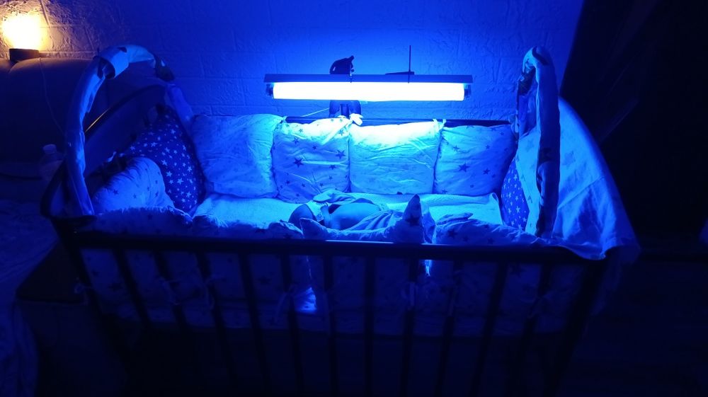 Медична лампа для лікування білірубіну / жовтянки/жовтушки