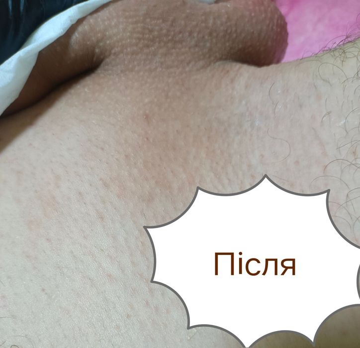 Професійна чоловіча депіляція, барбер, видалення волосся для чоловіків