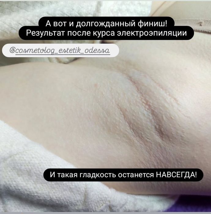 Электроэпиляция, Одесса,Таирова (Альтаир) Черемушки
