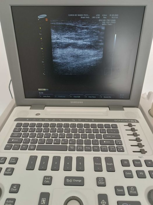 Ecografo Samsung Sonoacer R3