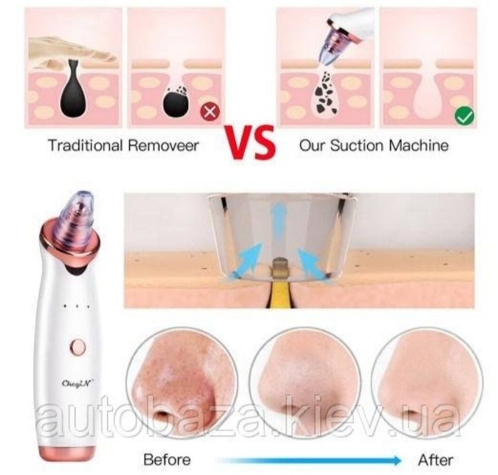 Вакуумный очиститель пор.