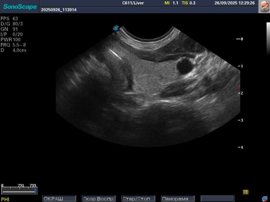 УЗИ\УЗД апарат SonoScape S8-Exp/Соноскейп/4 датчики/Еластографія/3D-4D