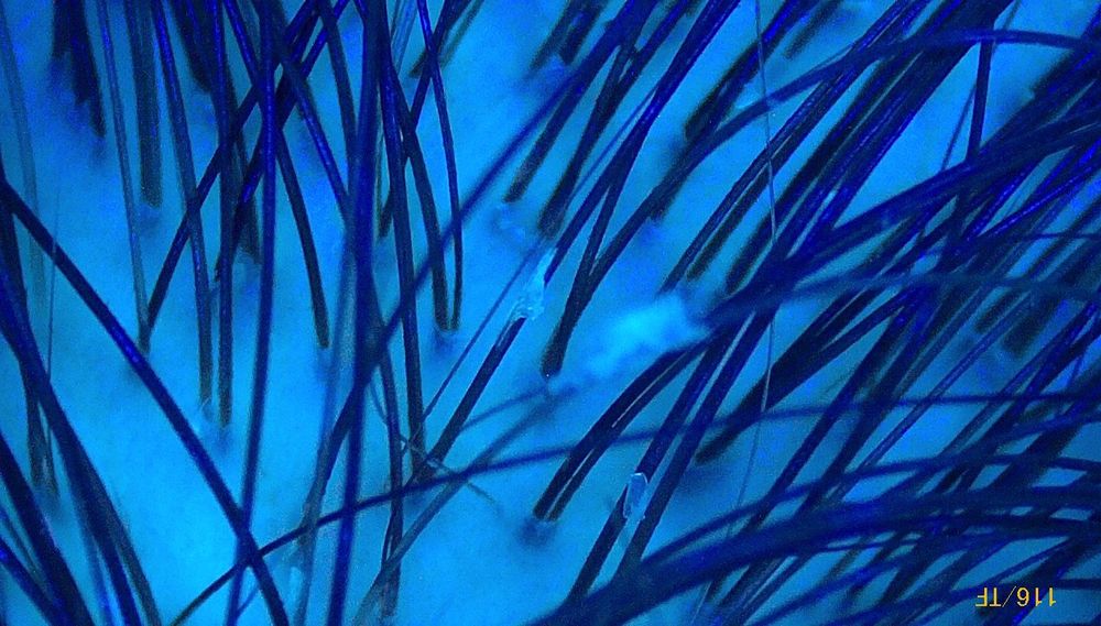 Badanie trichoskopowe w domu klienta