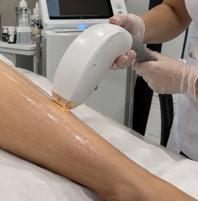 Depilação a laser  Lisboa Corpo Inteiro