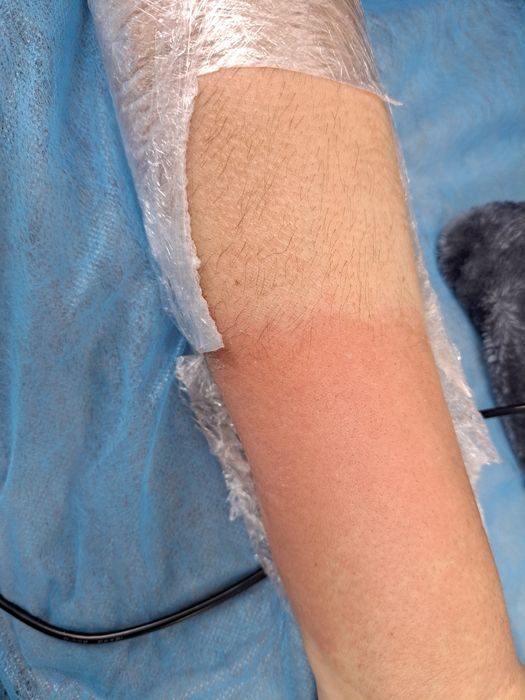 Електроепіляція, центр міста