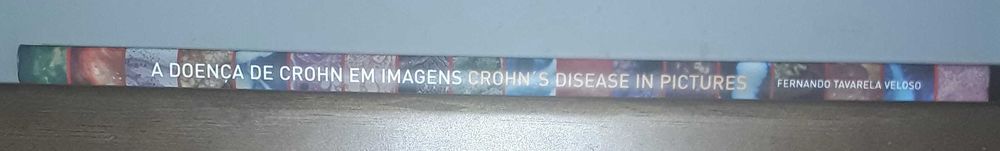 A Doença de Crohn em Imagens 1ª edição Fernando Tavarela Veloso