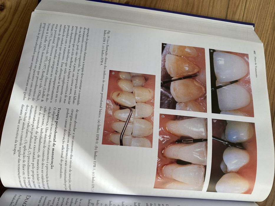 Livro Tratado de Periodontologia Clínica e Implantologia Oral