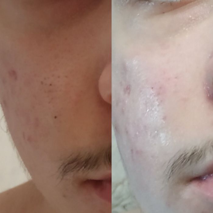 Косметолог. Ботокс, губи, векторний ліфтінг.