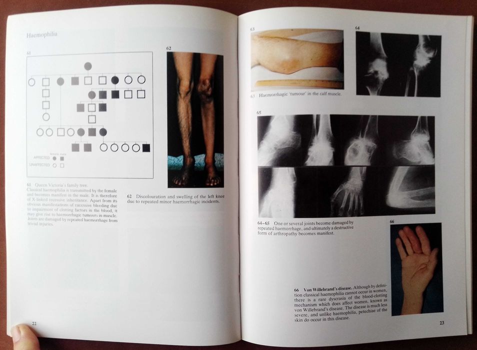 A Colour Atlas of Clinical Orthopaedics