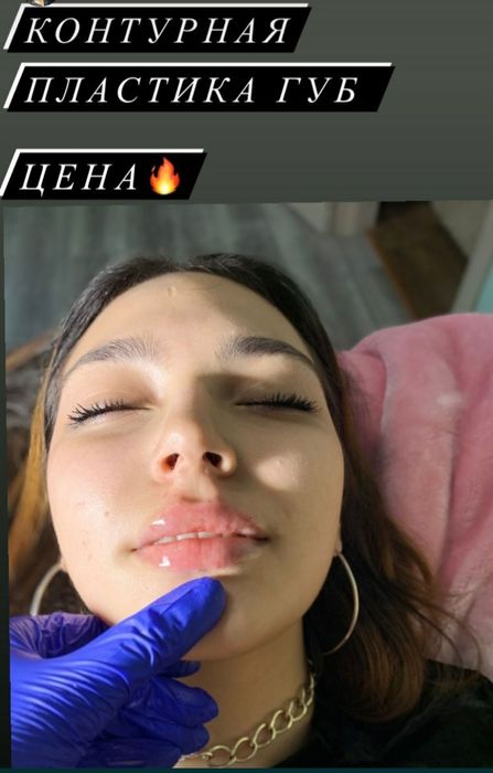 Губки ботокс гусинные лапки