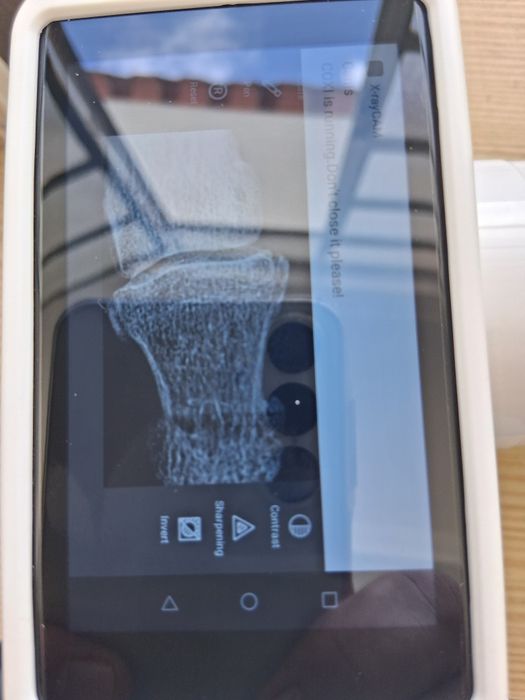 Raio-x portátel dentario novo com sensor RVG sem fio