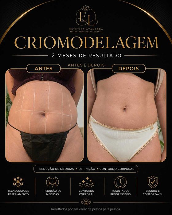 Massagem Terapêutica  e Estética avançada