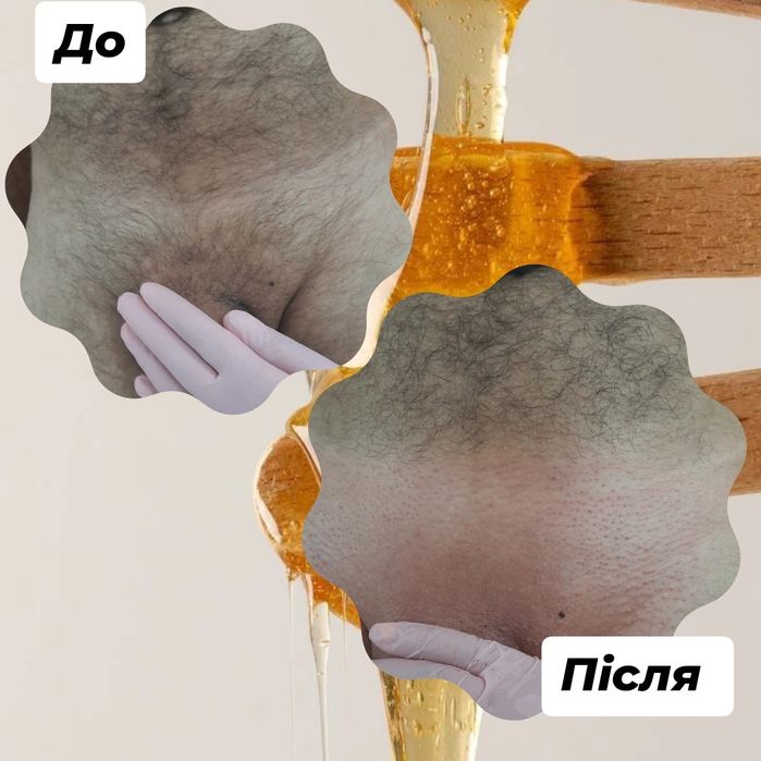 Воскова депіляція