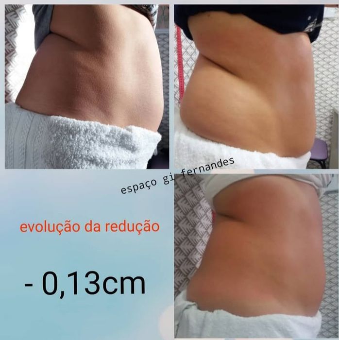 Serviço estético