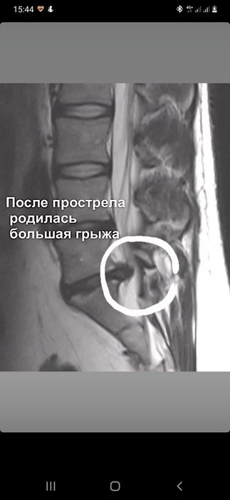 Лечение грыж,Остеопатия,Кинезиология,Мануальная терапия,PRP терапия