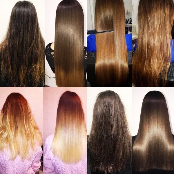 Keratynowe prostowanie, Krioterapia, NANOPLASTIA, Botox