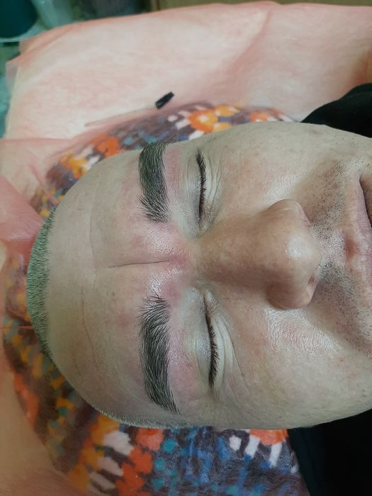 Чоловіча депіляція, видалення волосся для чоловіків на тілі та обличчі