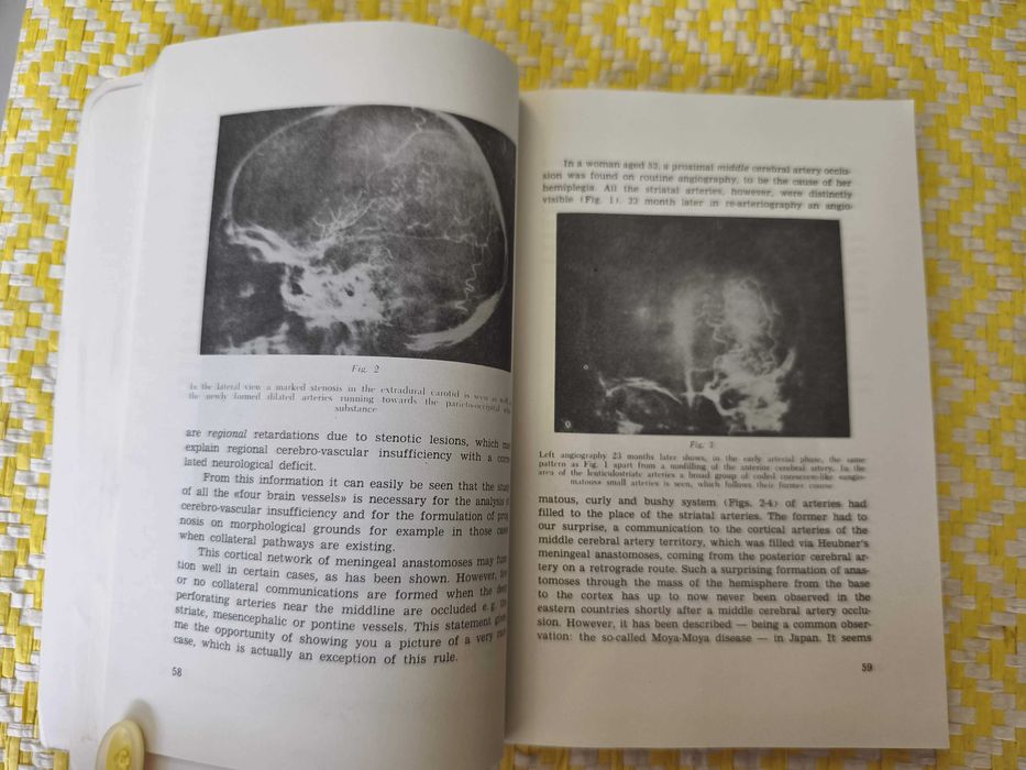 Egas Moniz Centenary . Scintific Reports