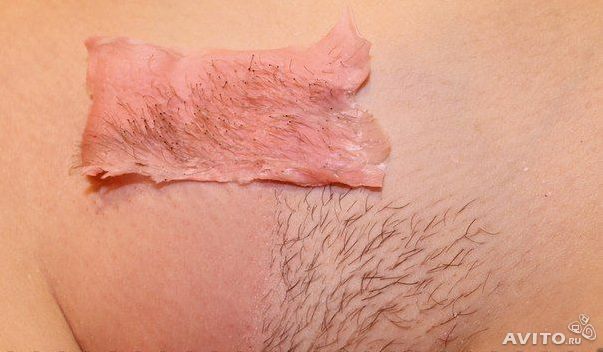 Депиляция бикини фото до и после Депиляция бикини фото до и после