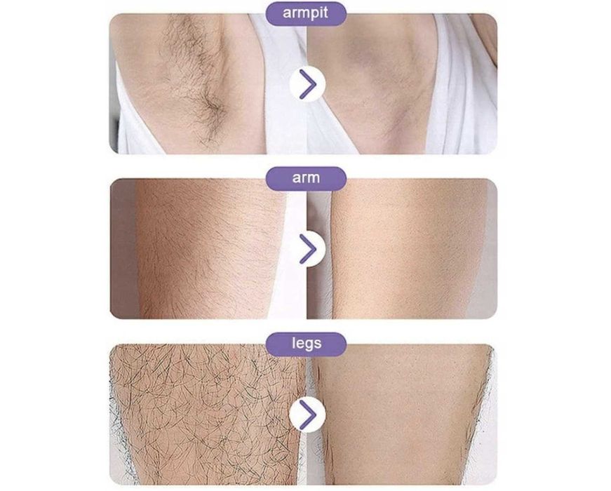 Epilator Bezbolesny Depilator Kryształowy Kamień do Depilacji Ciała