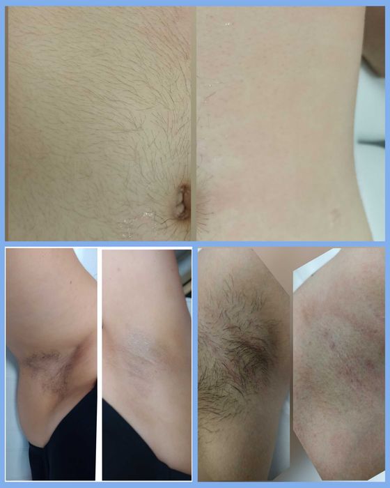 Salão de Beleza Depilação e estética masculina e feminina
