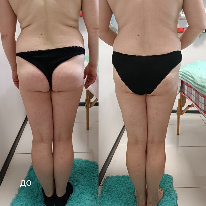 Масажист Троєщина, остеоп, корекція фігури.Масаж обли