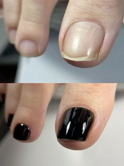 Педикюр Николаев.Чистые пятки без лезвия.600 грн.Стерильно