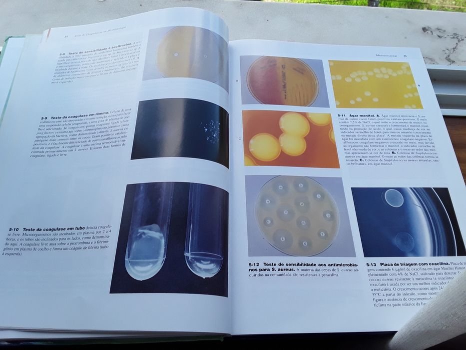 Vendo Atlas de Microbiologia Clínica. Novo.