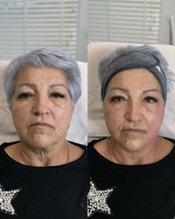 Міофасціальний масаж обличчя