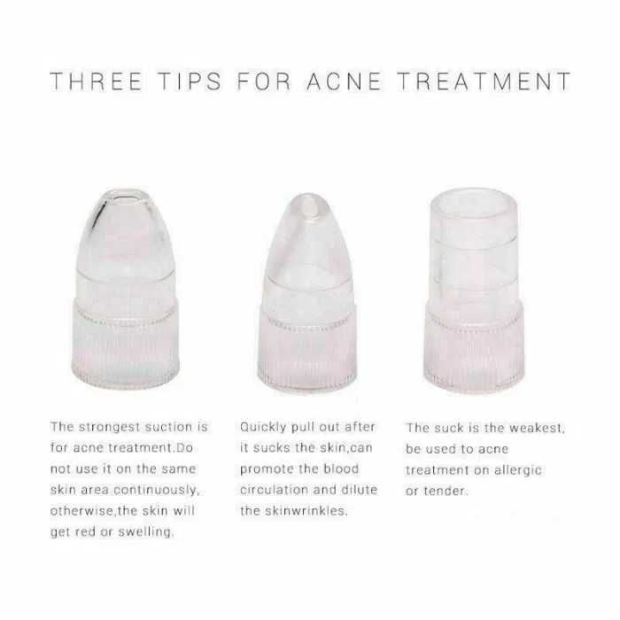 Microdermobrasão [BOLSA VERDE DE OFERTA]