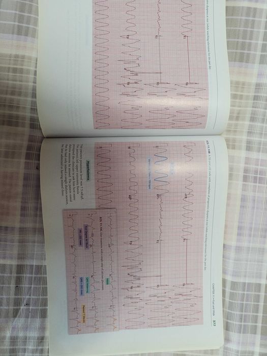 Medicina "A visual Guide to ECG interpretation" da Wolters Kluwer