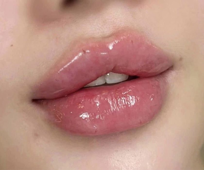 АКЦИЯ СКИДКИ Нужны МОДЕЛИ на увеличение губ для портфолио