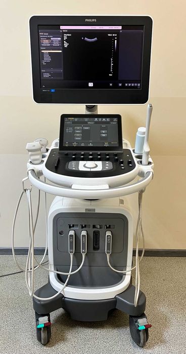 Апарат УЗД (УЗИ аппарат) PHILIPS Affiniti 70
