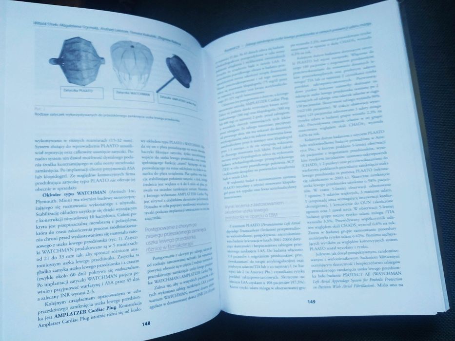 Migotanie przedsionków.