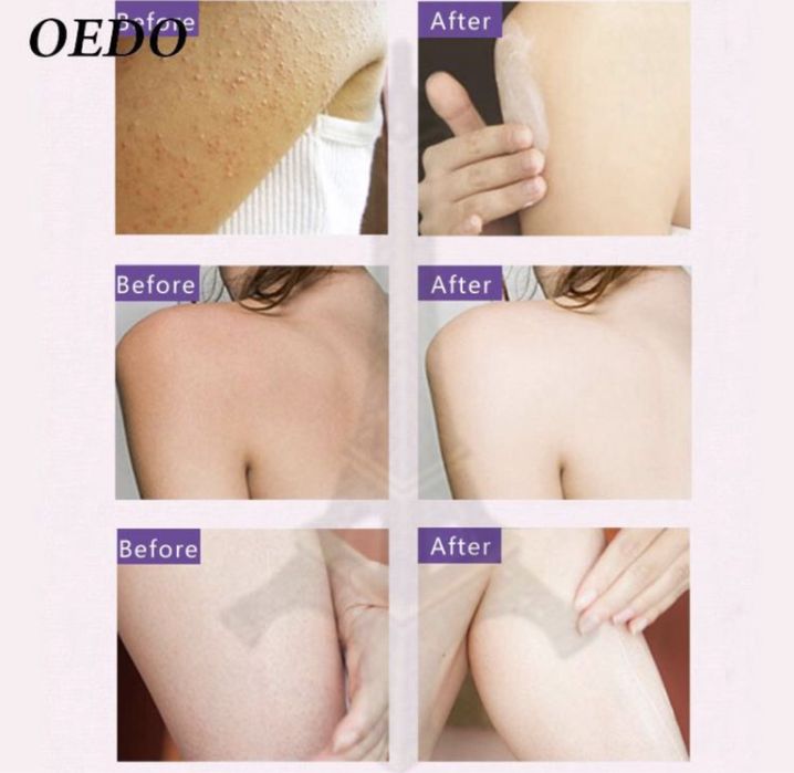 Лосьон для тела